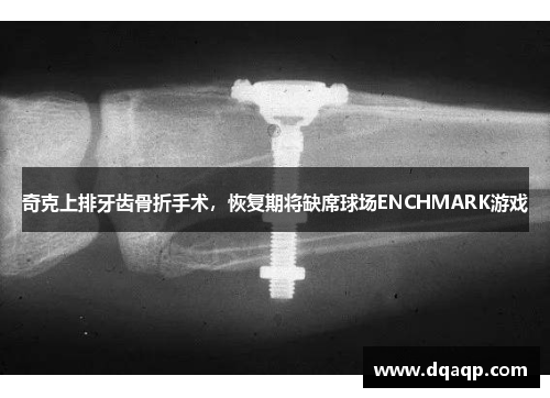 奇克上排牙齿骨折手术，恢复期将缺席球场ENCHMARK游戏